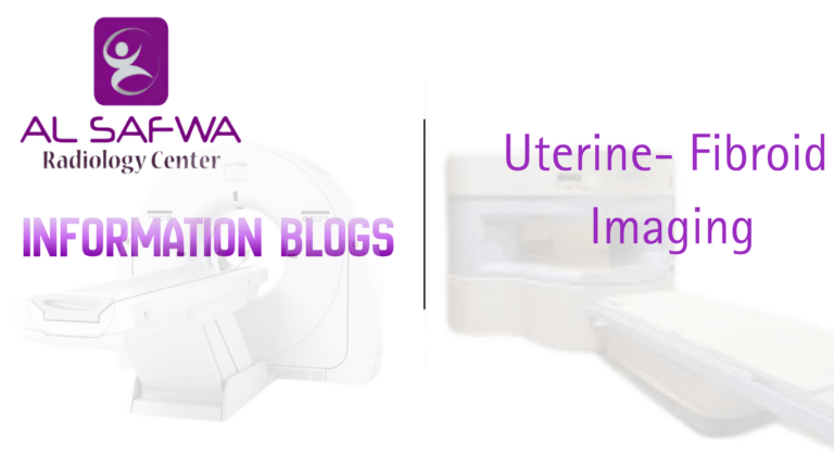 Uterine fibroid imaging